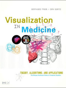 Visualization in Medicine: Theory, Algorithms, and Applications