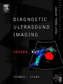 Diagnostic Ultrasound Imaging: Inside Out